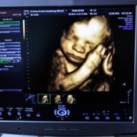 ecografo-fetal-mostrando-latidos-del-bebe