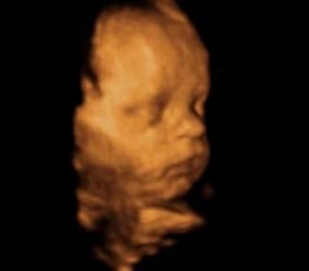 Cómo se ve el bebé a las 32 semanas de embarazo