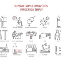 ilustracion-de-sintomas-de-virus-del-papiloma