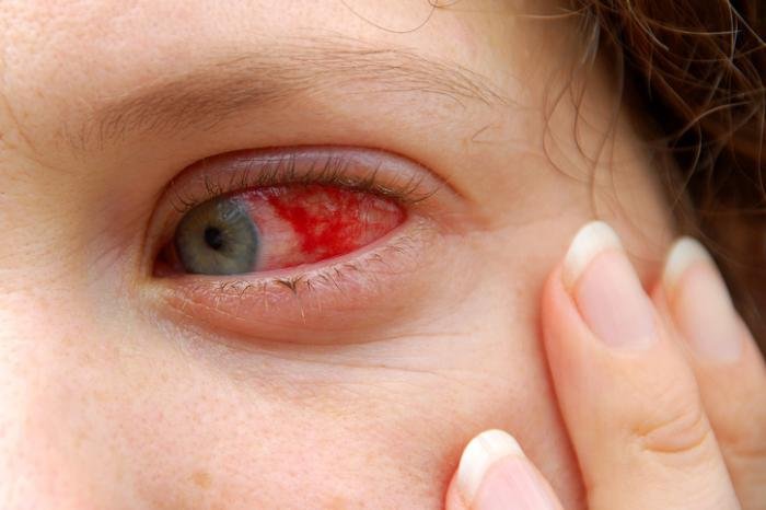 Cómo hidratar los ojos irritados: Consejos nutricionales para aliviar la irritación