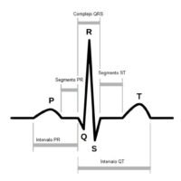 latido-de-corazon-en-electrocardiograma