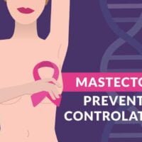 mastectomia-preventiva