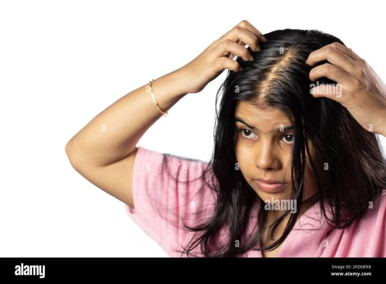 El estrés puede causar pérdida de cabello: ¿cómo prevenirlo?