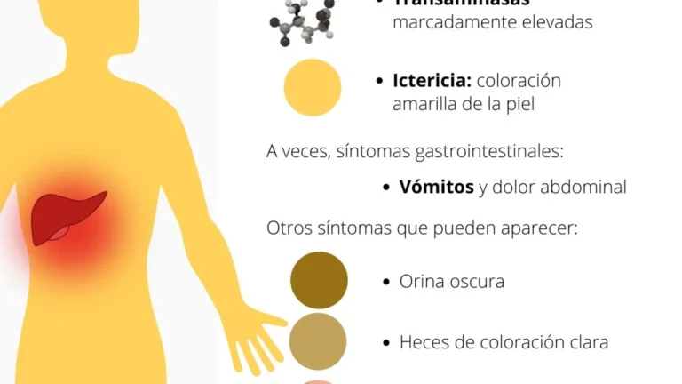 Qué es la hepatitis aguda infantil y cómo afecta a los niños en México