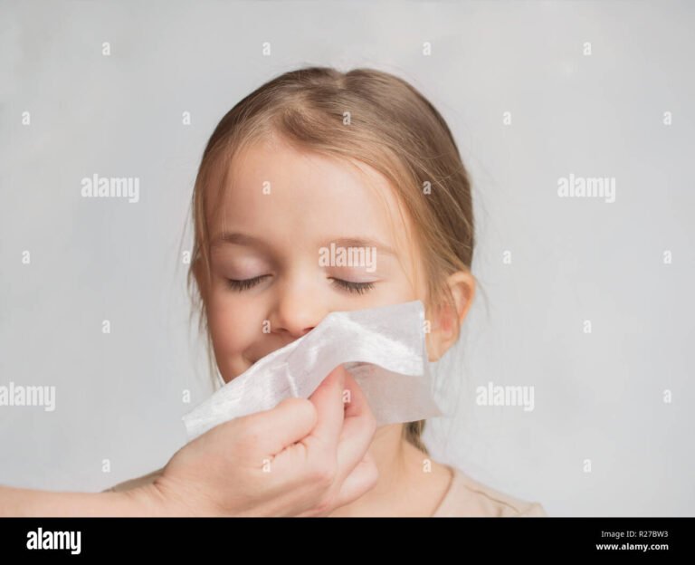 Cómo quitar lo mormado de la nariz rápido: métodos eficaces