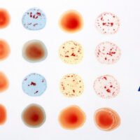 pruebas-de-laboratorio-para-conocer-tipo-sanguineo