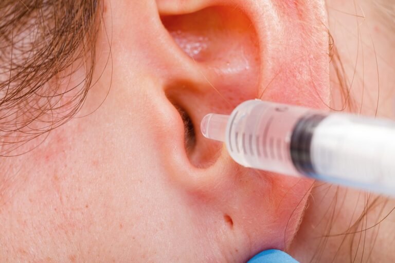 Cómo quitar un tapón de cera del oído en casa con agua oxigenada